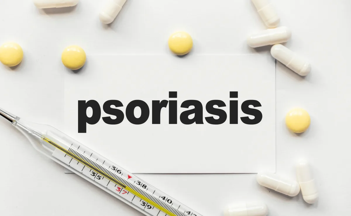 FDA a aprobat ICOTYDE, o nouă opțiune orală pentru psoriazisul în plăci moderat până la sever