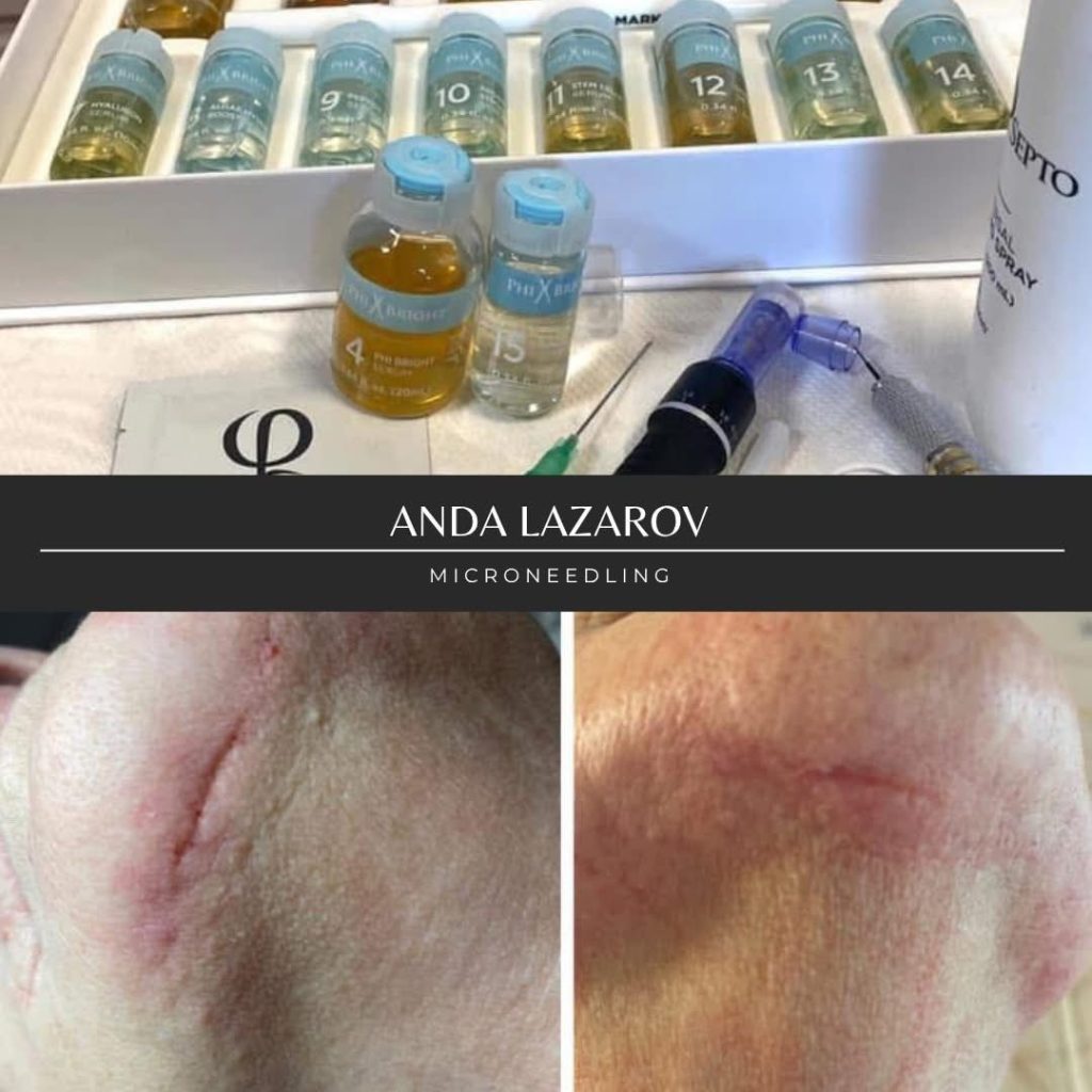 Anda Lazarov – Locul I la Geneva, Elveția (2020), o confirmare a excelenței în estetica profesională